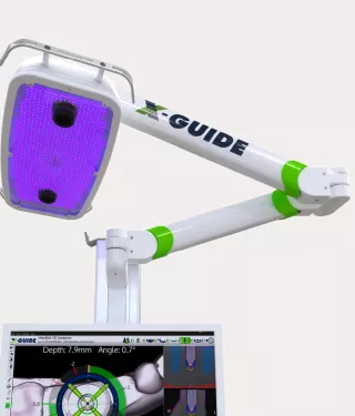 健康・医学 Ultimate Guide IMPLANTS X-GUIDE - Chirurgie ghidata in timp real - Implant Distribution